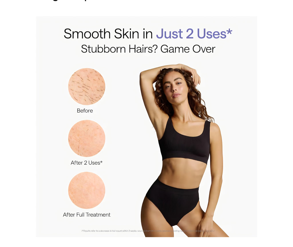 ULIKE IPL HAIR REMOVAL DEVICE